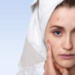 Saskatoon Residents: Skin Signs of Hidden Health Issues