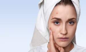 Saskatoon Residents: Skin Signs of Hidden Health Issues